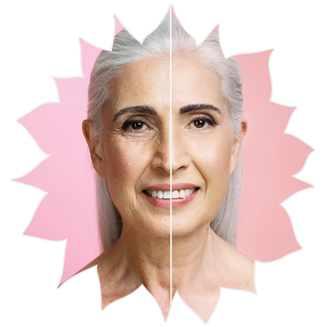 Harmonização Facial e Botox em São Paulo